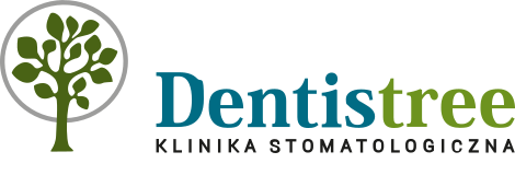 Czy licówki można zdjąć? - Dentistree